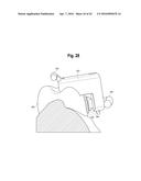 TOOTH ATTACHMENT PLACEMENT DEVICE diagram and image