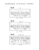 TOOTH ATTACHMENT PLACEMENT DEVICE diagram and image