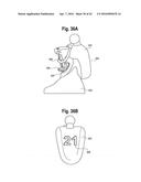 TOOTH ATTACHMENT PLACEMENT DEVICE diagram and image