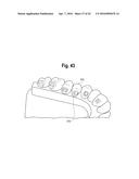 TOOTH ATTACHMENT PLACEMENT DEVICE diagram and image