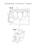 TOOTH ATTACHMENT PLACEMENT DEVICE diagram and image