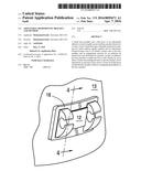 ADJUSTABLE ORTHODONTIC BRACKET AND METHOD diagram and image