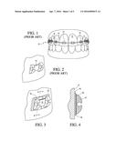 ADJUSTABLE ORTHODONTIC BRACKET AND METHOD diagram and image