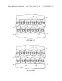 ORTHODONTIC BRACKET diagram and image