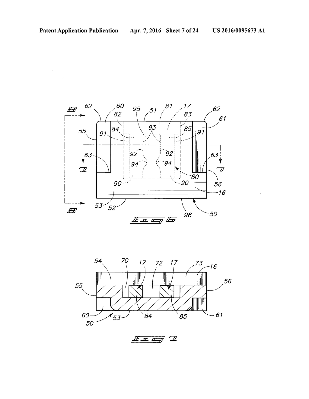 ORTHODONTIC BRACKET - diagram, schematic, and image 08