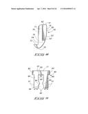 ORTHODONTIC BRACKET diagram and image