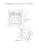 ORTHODONTIC BRACKET diagram and image