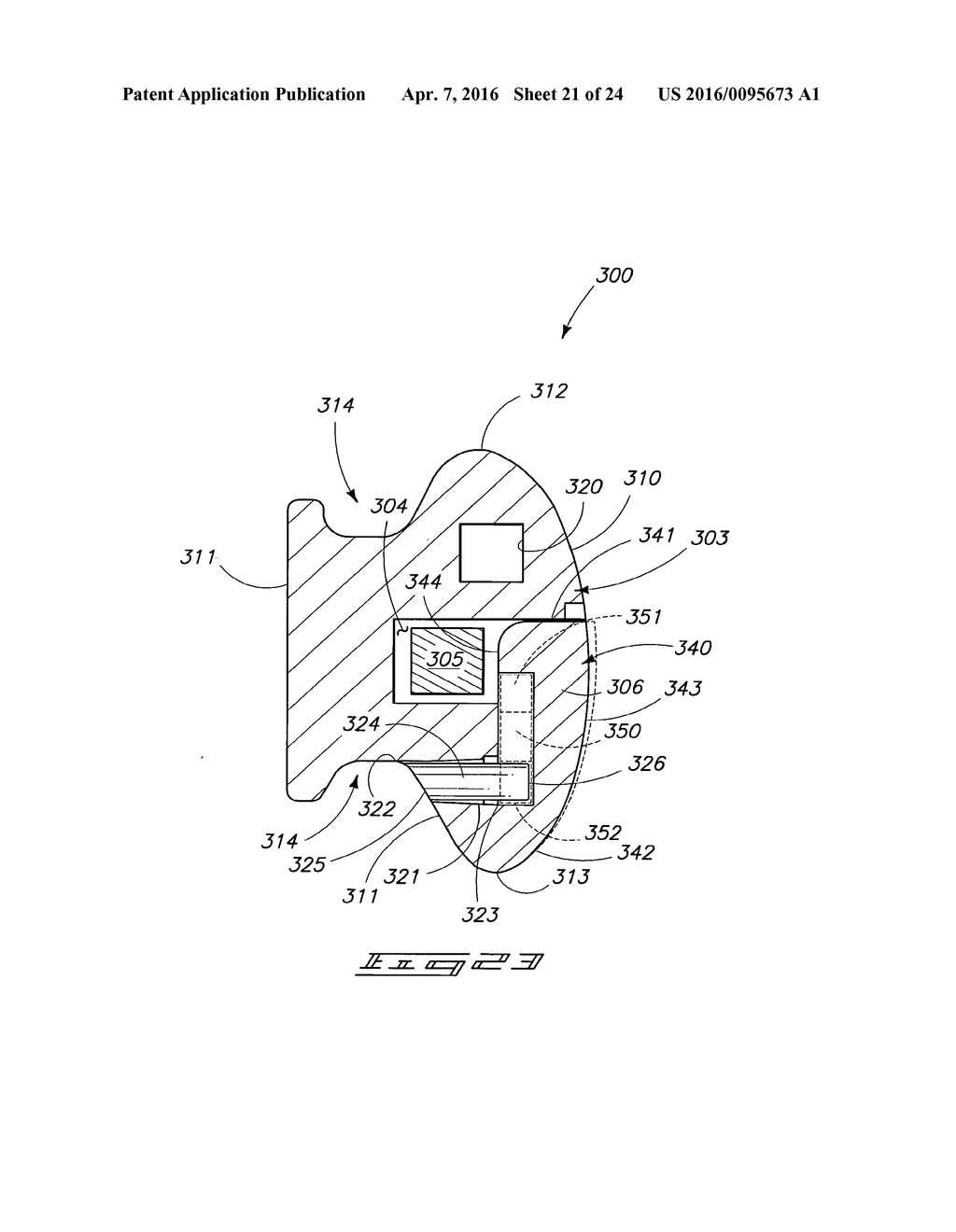 ORTHODONTIC BRACKET - diagram, schematic, and image 22