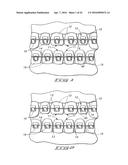 ORTHODONTIC BRACKET diagram and image