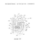 ORTHODONTIC BRACKET diagram and image