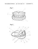 APPARATUS AND METHODS OF MAKING DENTURE DEVICES diagram and image