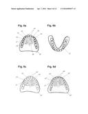 APPARATUS AND METHODS OF MAKING DENTURE DEVICES diagram and image