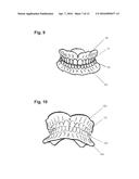 APPARATUS AND METHODS OF MAKING DENTURE DEVICES diagram and image