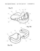 APPARATUS AND METHODS OF MAKING DENTURE DEVICES diagram and image