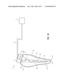 APPARATUS AND METHODS FOR CLEANING TEETH AND ROOT CANALS diagram and image