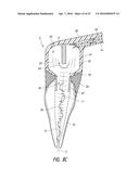 APPARATUS AND METHODS FOR CLEANING TEETH AND ROOT CANALS diagram and image