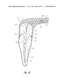 APPARATUS AND METHODS FOR CLEANING TEETH AND ROOT CANALS diagram and image