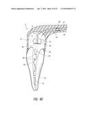 APPARATUS AND METHODS FOR CLEANING TEETH AND ROOT CANALS diagram and image