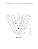 APPARATUS AND METHODS FOR CLEANING TEETH AND ROOT CANALS diagram and image