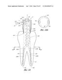 APPARATUS AND METHODS FOR CLEANING TEETH AND ROOT CANALS diagram and image