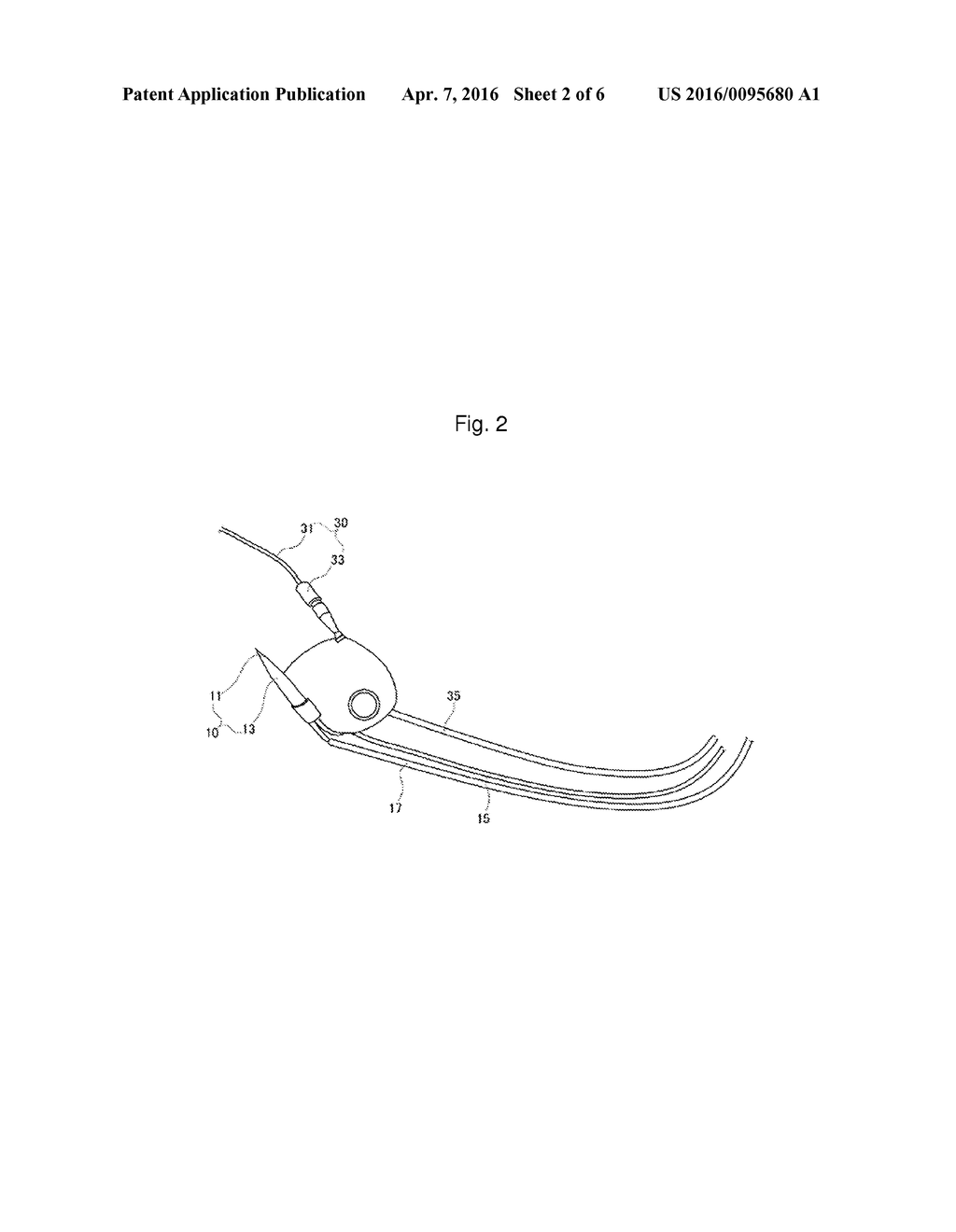 METHOD AND APPARATUS FOR SCALING TEETH - diagram, schematic, and image 03