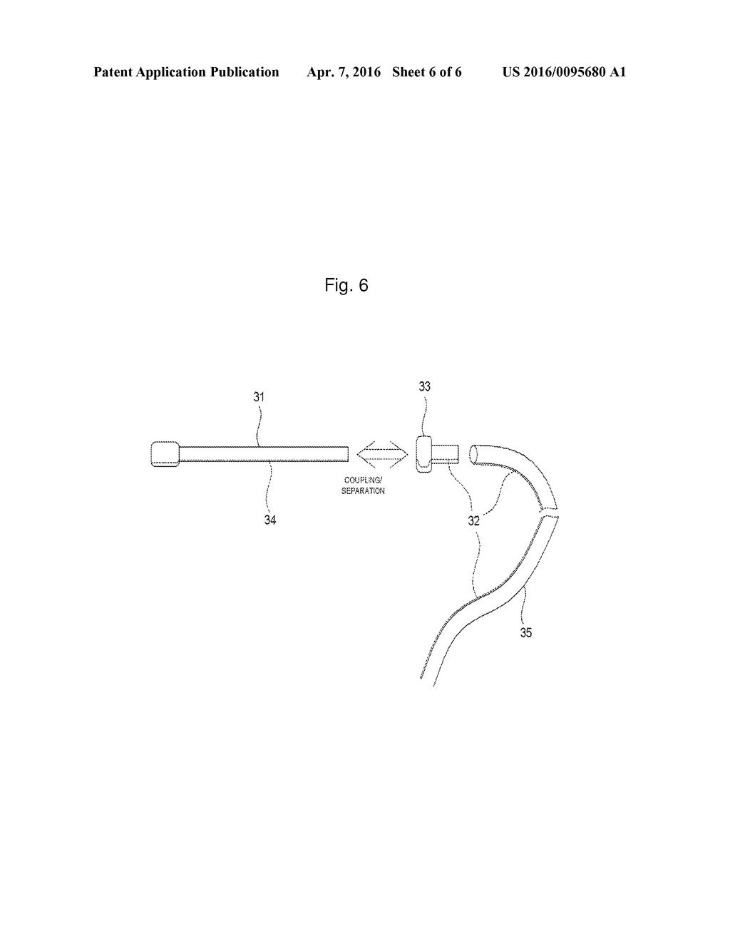 METHOD AND APPARATUS FOR SCALING TEETH - diagram, schematic, and image 07