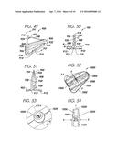 SYSTEMS AND METHODS FOR INCONTINENCE CONTROL diagram and image