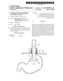 ANTI-REFLUX DEVICES AND METHODS FOR TREATING GASTRO-ESOPHAGEAL REFLUX     DISEASE (GERD) diagram and image
