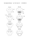 ANTI-REFLUX DEVICES AND METHODS FOR TREATING GASTRO-ESOPHAGEAL REFLUX     DISEASE (GERD) diagram and image