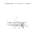 ANTI-REFLUX DEVICES AND METHODS FOR TREATING GASTRO-ESOPHAGEAL REFLUX     DISEASE (GERD) diagram and image