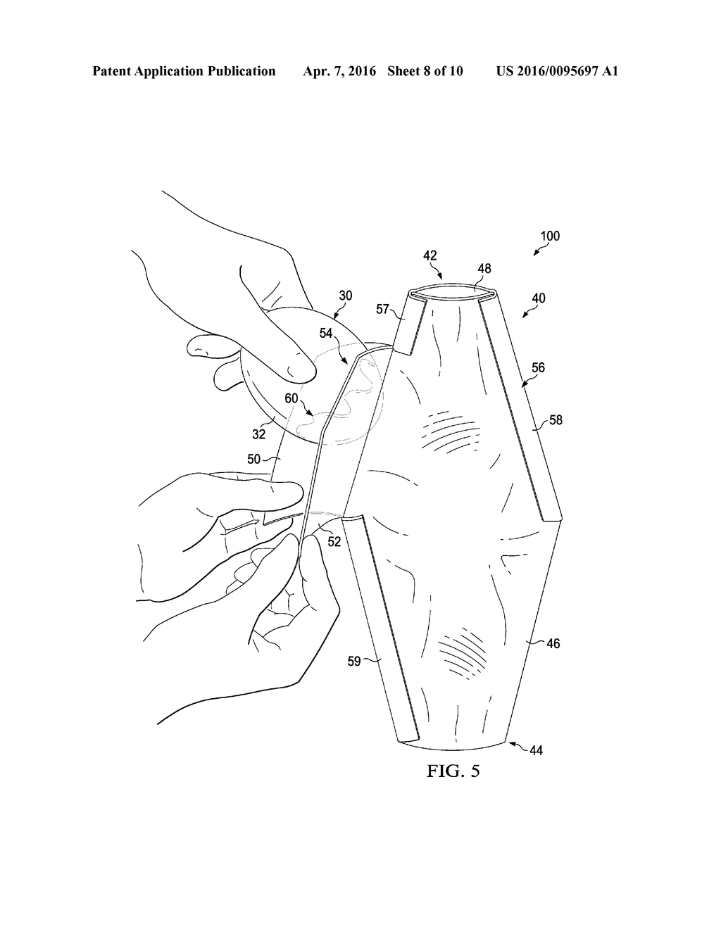 Inverse Bellow Prosthesis Insertion Device - diagram, schematic, and image 09