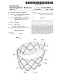 Bi-Leaflet Mitral Valve Design diagram and image