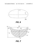 Bi-Leaflet Mitral Valve Design diagram and image