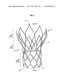 FLEXIBLE CATHETERS AND METHODS OF FORMING SAME diagram and image