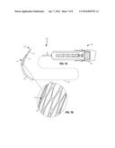 FLEXIBLE CATHETERS AND METHODS OF FORMING SAME diagram and image