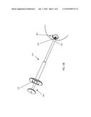 MICROFRACTURE APPARATUSES AND METHODS diagram and image