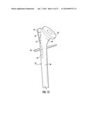 SYSTEM FOR TREATING PROXIMAL HUMERAL FRACTURES AND METHOD OF USING THE     SAME diagram and image