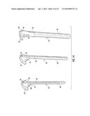 SYSTEM FOR TREATING PROXIMAL HUMERAL FRACTURES AND METHOD OF USING THE     SAME diagram and image