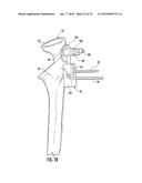 SYSTEM FOR TREATING PROXIMAL HUMERAL FRACTURES AND METHOD OF USING THE     SAME diagram and image