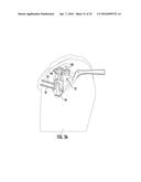 SYSTEM FOR TREATING PROXIMAL HUMERAL FRACTURES AND METHOD OF USING THE     SAME diagram and image