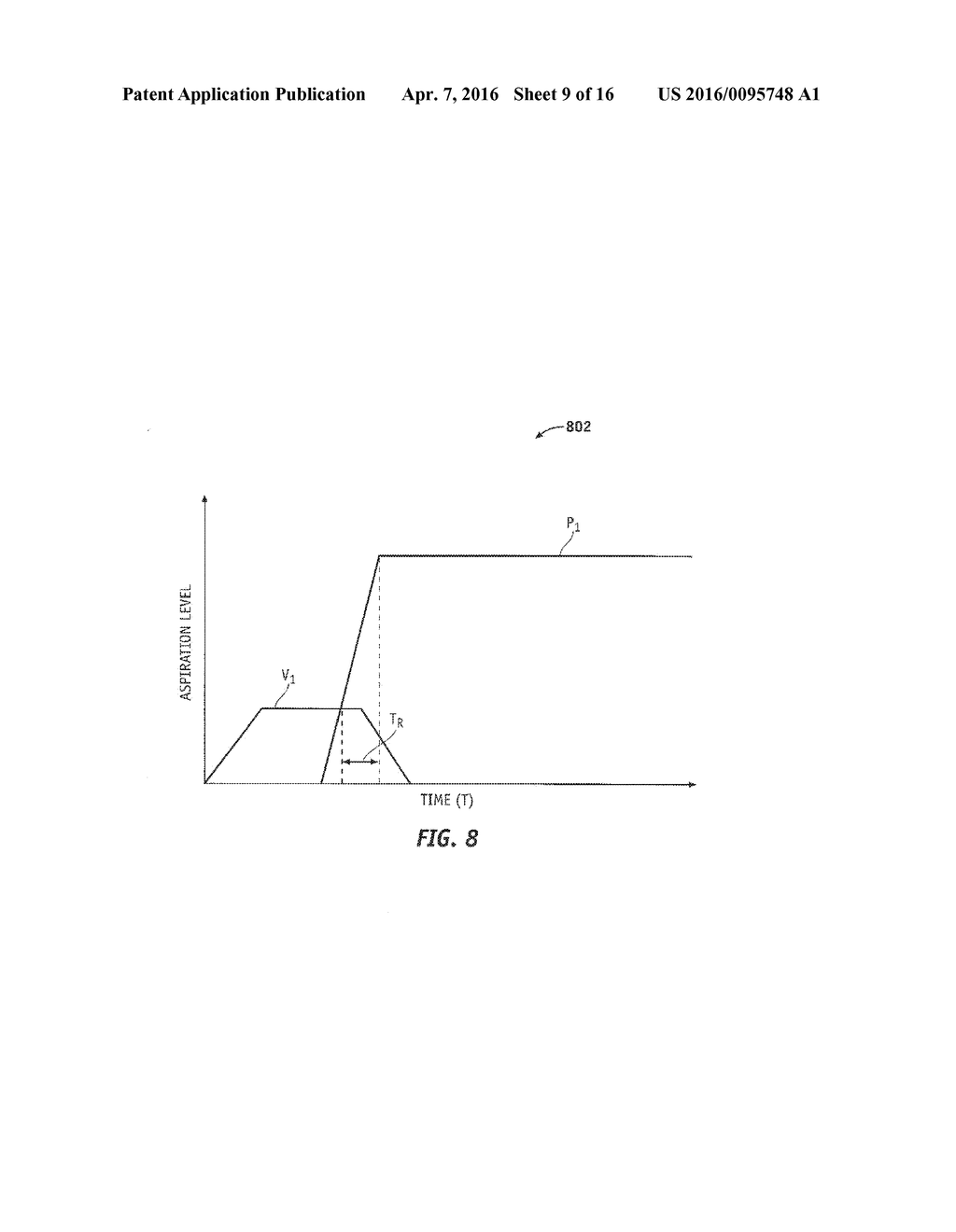 AUTOMATICALLY PULSING DIFFERENT ASPIRATION LEVELS TO AN OCULAR PROBE - diagram, schematic, and image 10