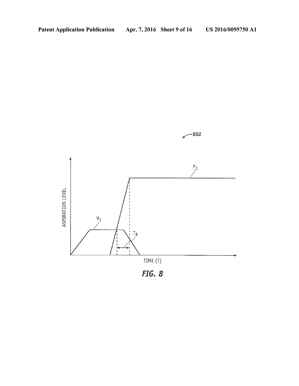 AUTOMATICALLY PULSING DIFFERENT ASPIRATION LEVELS TO AN OCULAR PROBE - diagram, schematic, and image 10