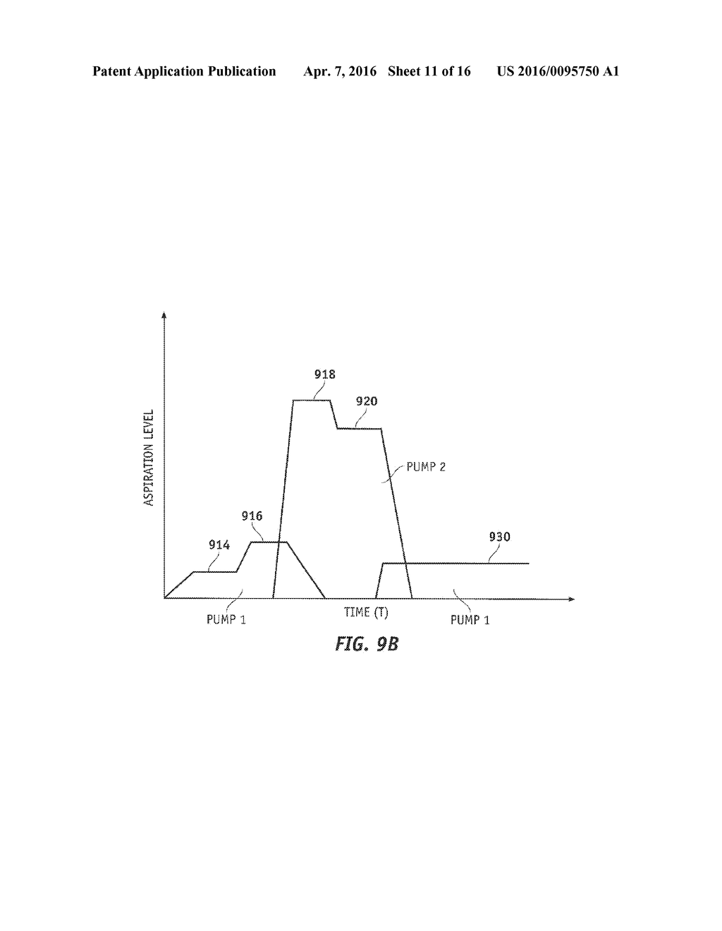 AUTOMATICALLY PULSING DIFFERENT ASPIRATION LEVELS TO AN OCULAR PROBE - diagram, schematic, and image 12