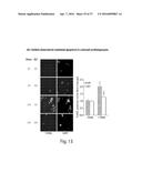 BET INHIBITION THERAPY FOR HEART DISEASE diagram and image