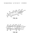 REMOVABLE COVERS FOR DRUG ELUTING MEDICAL DEVICES diagram and image