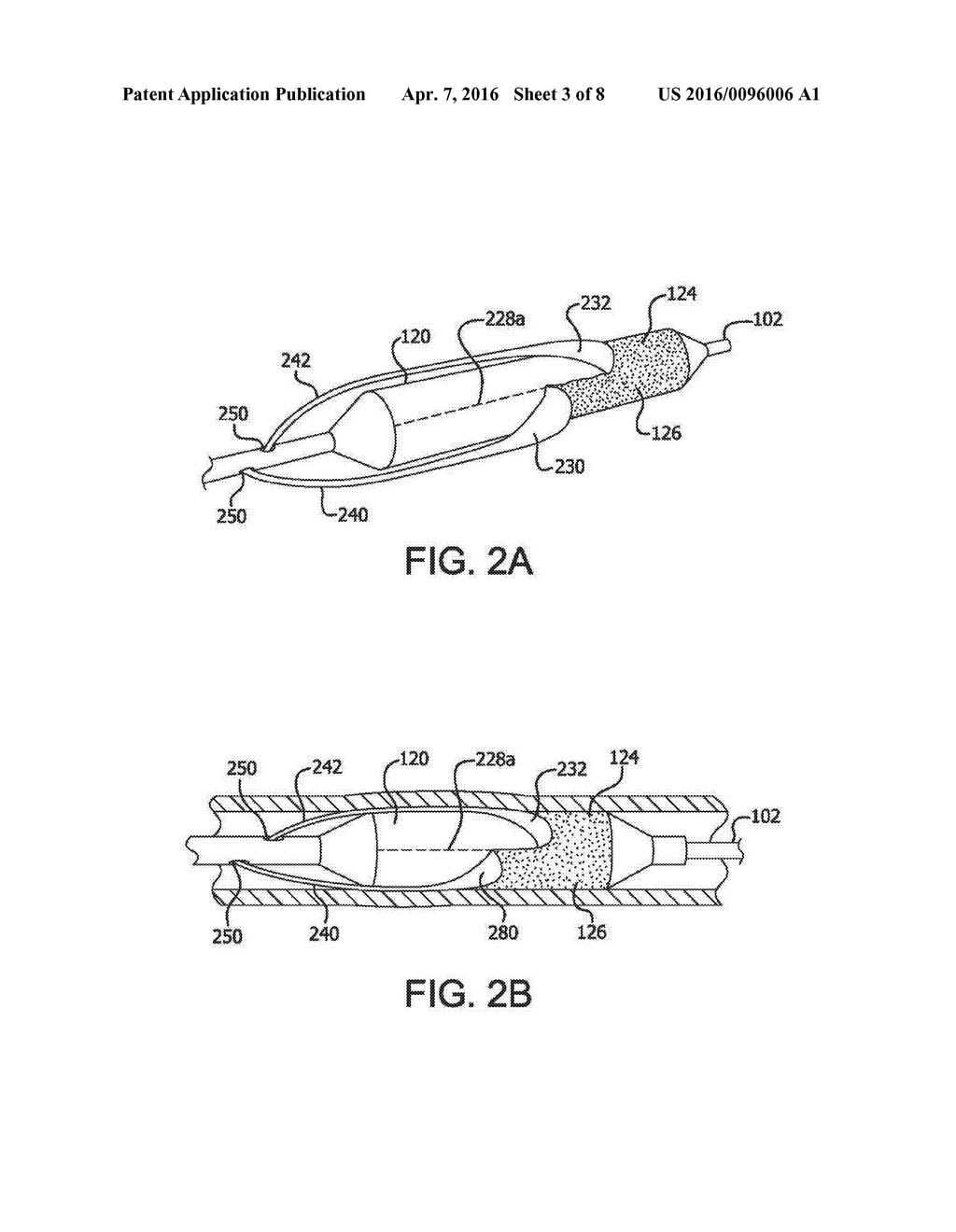 REMOVABLE COVERS FOR DRUG ELUTING MEDICAL DEVICES - diagram, schematic, and image 04