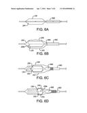 REMOVABLE COVERS FOR DRUG ELUTING MEDICAL DEVICES diagram and image