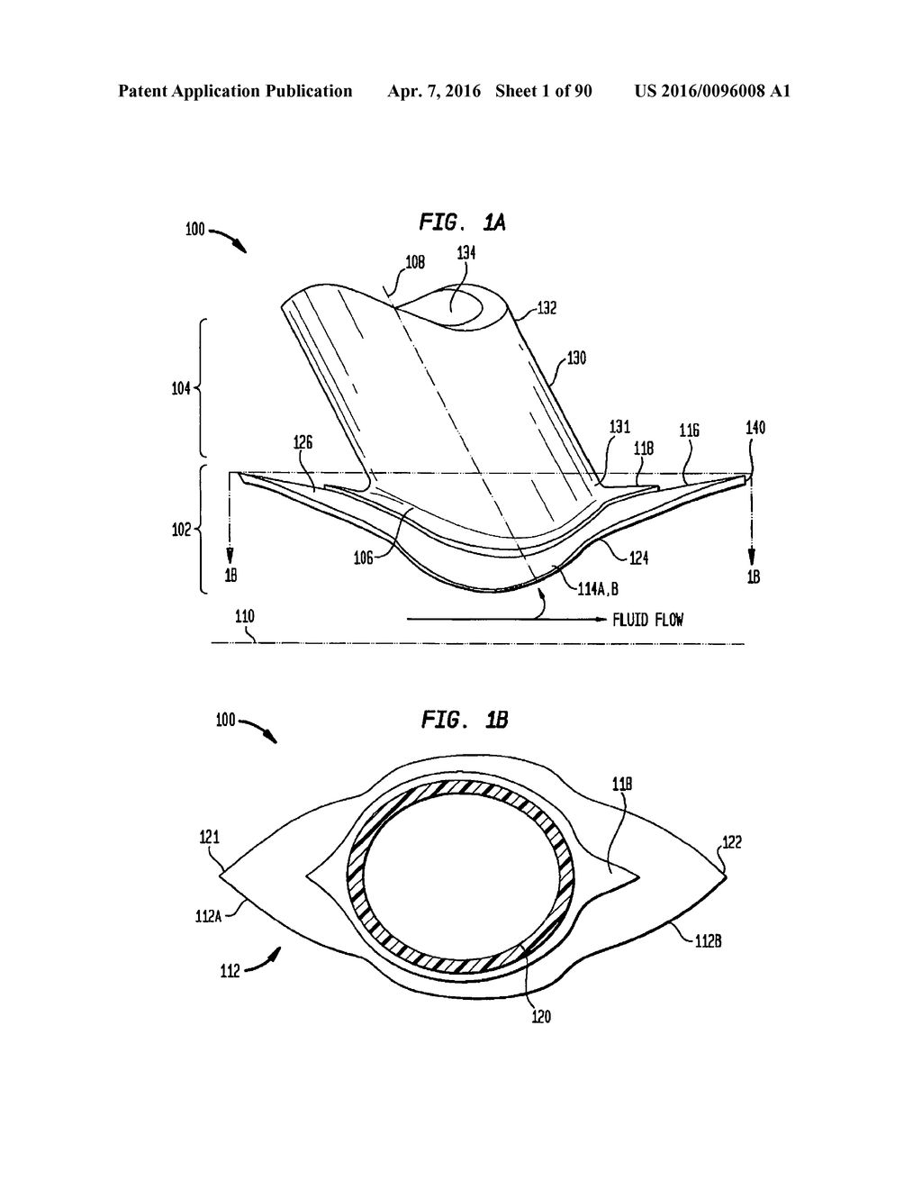 IMPLANTABLE FLOW CONNECTOR - diagram, schematic, and image 02