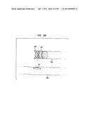 IMPLANTABLE FLOW CONNECTOR diagram and image