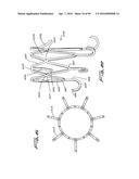 IMPLANTABLE FLOW CONNECTOR diagram and image